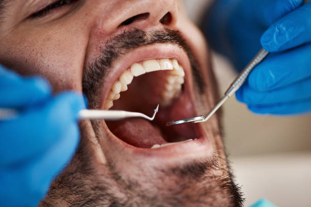Best Emergency Denture Repair in Reidland, KY